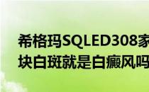 希格玛SQLED308家庭光疗科普：脸上长一块白斑就是白癜风吗？