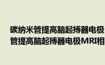 碳纳米管提高脑起搏器电极MRI相容性的研究(关于碳纳米管提高脑起搏器电极MRI相容性的研究的简介)