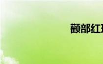 颧部红斑 颧部