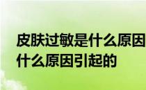 皮肤过敏是什么原因越来越严重 皮肤过敏是什么原因引起的