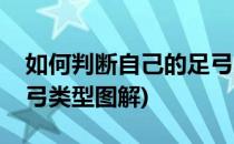 如何判断自己的足弓类型(如何判断自己的足弓类型图解)