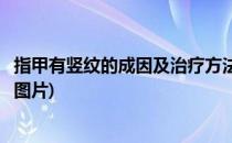 指甲有竖纹的成因及治疗方法(指甲有竖纹的成因及治疗方法图片)