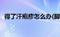 得了汗疱疹怎么办(脚上得了汗疱疹怎么办)