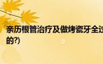 亲历根管治疗及做烤瓷牙全过程(做烤瓷牙根管治疗是怎样做的?)