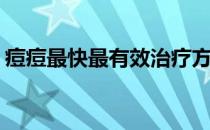 痘痘最快最有效治疗方法(痘痘最佳治疗方法)