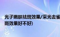 光子嫩肤祛斑效果/采光去雀斑好吗/e光管用吗(光子嫩肤祛斑效果好不好)