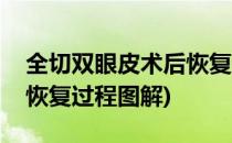 全切双眼皮术后恢复过程图(全切双眼皮术后恢复过程图解)