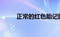 正常的红色胎记图片（胎记图片）