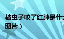 被虫子咬了红肿是什么虫子（被虫子咬了红肿图片）
