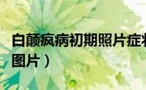 白颠疯病初期照片症状图片（白颠病初期白点图片）