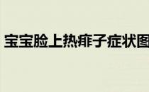 宝宝脸上热痱子症状图片（热痱子症状图片）