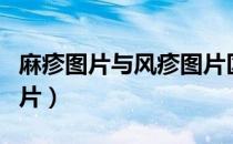 麻疹图片与风疹图片区别（麻疹图片与风疹图片）