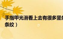 手指甲光滑看上去有很多竖条纹咋回事（手指甲不光滑有竖条纹）