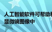 人工智能软件可帮助科学家快速准确地从电子显微镜图像中