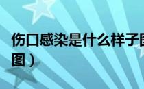 伤口感染是什么样子图（伤口感染是什么样子图）