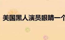 美国黑人演员眼睛一个有问题 美国黑人演员