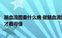 脑血流图查什么病 做脑血流图是检查什么有什么作用怎么看才看得懂