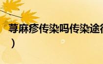 荨麻疹传染吗传染途径是什么（荨麻疹传染吗）