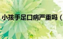 小孩手足口病严重吗（小孩手足口病严重吗）