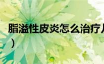 脂溢性皮炎怎么治疗儿童（脂溢性皮炎怎么治）