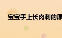 宝宝手上长肉刺的原因（如何预防倒刺）
