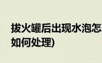拔火罐后出现水泡怎么处理(拔火罐出现水泡如何处理)