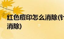 红色痘印怎么消除(针清完留下红色痘印怎么消除)