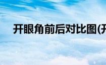 开眼角前后对比图(开眼角前后对比图片)
