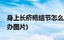 身上长疥疮结节怎么办(身上长疥疮结节怎么办图片)