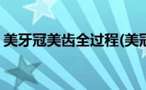美牙冠美齿全过程(美冠修复牙齿的过程视频)