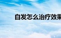 白发怎么治疗效果好 白发怎么治疗