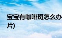 宝宝有咖啡斑怎么办(宝宝有咖啡斑怎么办图片)