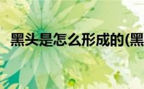 黑头是怎么形成的(黑头是怎么形成的视频)