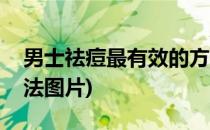 男士祛痘最有效的方法(男士祛痘最有效的方法图片)