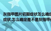 灰指甲图片初期症状怎么确定是不是灰指甲(灰指甲图片初期症状,怎么确定是不是灰指甲传染)
