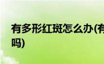 有多形红斑怎么办(有多形红斑怎么办能治好吗)