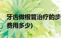 牙齿做根管治疗的步骤和费用(作牙根管治疗费用多少)