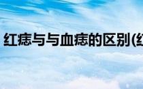 红痣与与血痣的区别(红痣与与血痣的区别图)