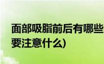 面部吸脂前后有哪些事项要注意(面部吸脂前要注意什么)