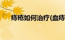痔疮如何治疗(血痔疮的最佳治疗方法)