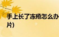 手上长了冻疮怎么办(手上长了冻疮怎么办图片)