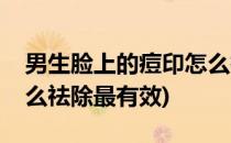 男生脸上的痘印怎么祛除(男生脸上的痘印怎么祛除最有效)