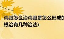 鸡眼怎么治鸡眼是怎么形成的脚鸡眼怎么治(脚上的鸡眼怎么根治有几种治法)