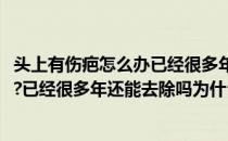 头上有伤疤怎么办已经很多年还能去除吗(头上有伤疤怎么办?已经很多年还能去除吗为什么)