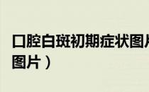 口腔白斑初期症状图片舌（口腔白斑初期症状图片）