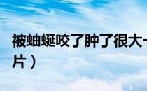 被蚰蜒咬了肿了很大一块（被蚰蜒咬了症状图片）