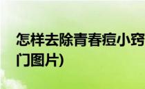 怎样去除青春痘小窍门(怎样去除青春痘小窍门图片)