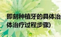 即刻种植牙的具体治疗过程(即刻种植牙的具体治疗过程步骤)