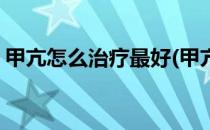 甲亢怎么治疗最好(甲亢怎么治疗最好的方法)