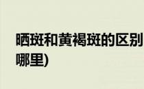 晒斑和黄褐斑的区别(晒斑和黄褐斑的区别在哪里)
